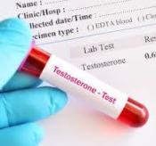Testosterone Test